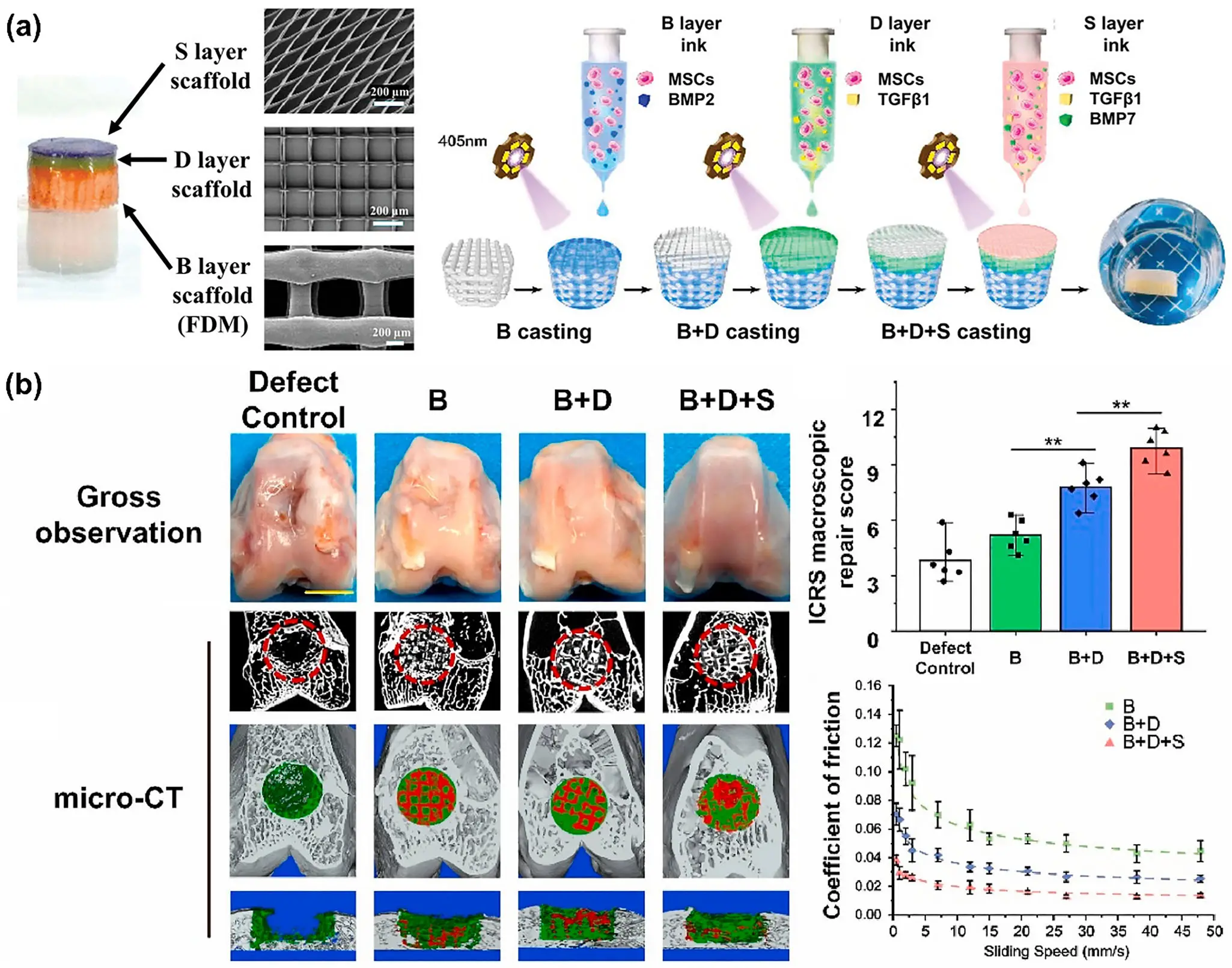 图13：骨-软骨三层复合修复